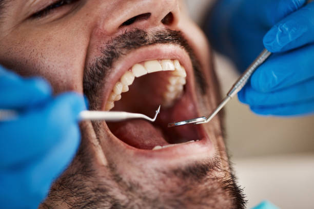Best After-Hours Dental Trauma Care in Petersburg, AK