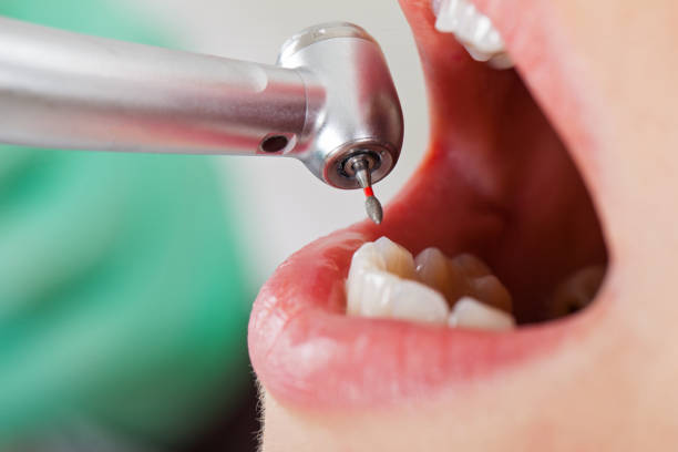 Best Emergency Dental Care for Broken or Chipped Teeth in Petersburg, AK